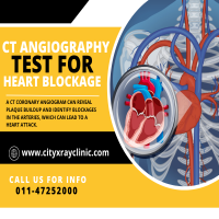 Best Diagnostic Centre For CT coronary scans Near Me In Delhi 